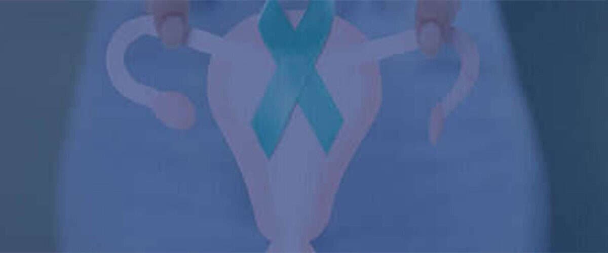 Θεραπεία Καρκίνου των Ωοθηκών