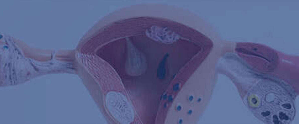 Συμπτώματα καρκίνου του ενδομητρίου